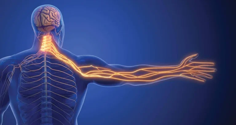 دليلك لمواجهة مشكلة «انضغاط العصب»