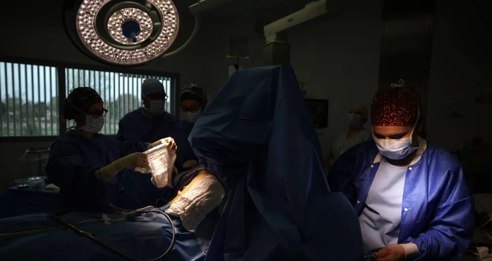 دراسة: استئصال الزائدة الدودية الملتهبة قد يقلل خطر الإصابة بسرطان القولون