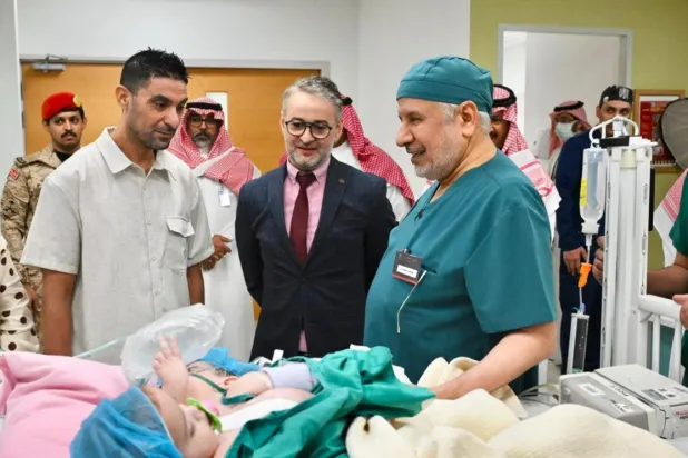 نجاح عملية فصل التوأم الملتصق المغربي «سجى وضحى»