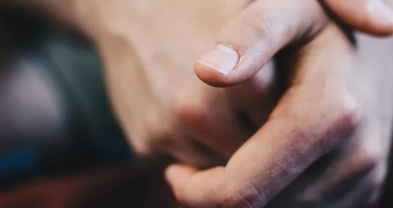 علامة في الأظافر قد تشير إلى الإصابة بأمراض القلب والسرطان