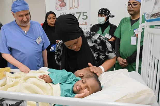 بدء عملية فصل التوأم الملتصق التنزاني «لايتيينس ولوفنس»